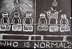 Who is normal? In darkness the blind see better